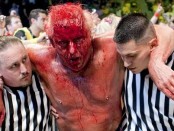 Ric Flair bleeding